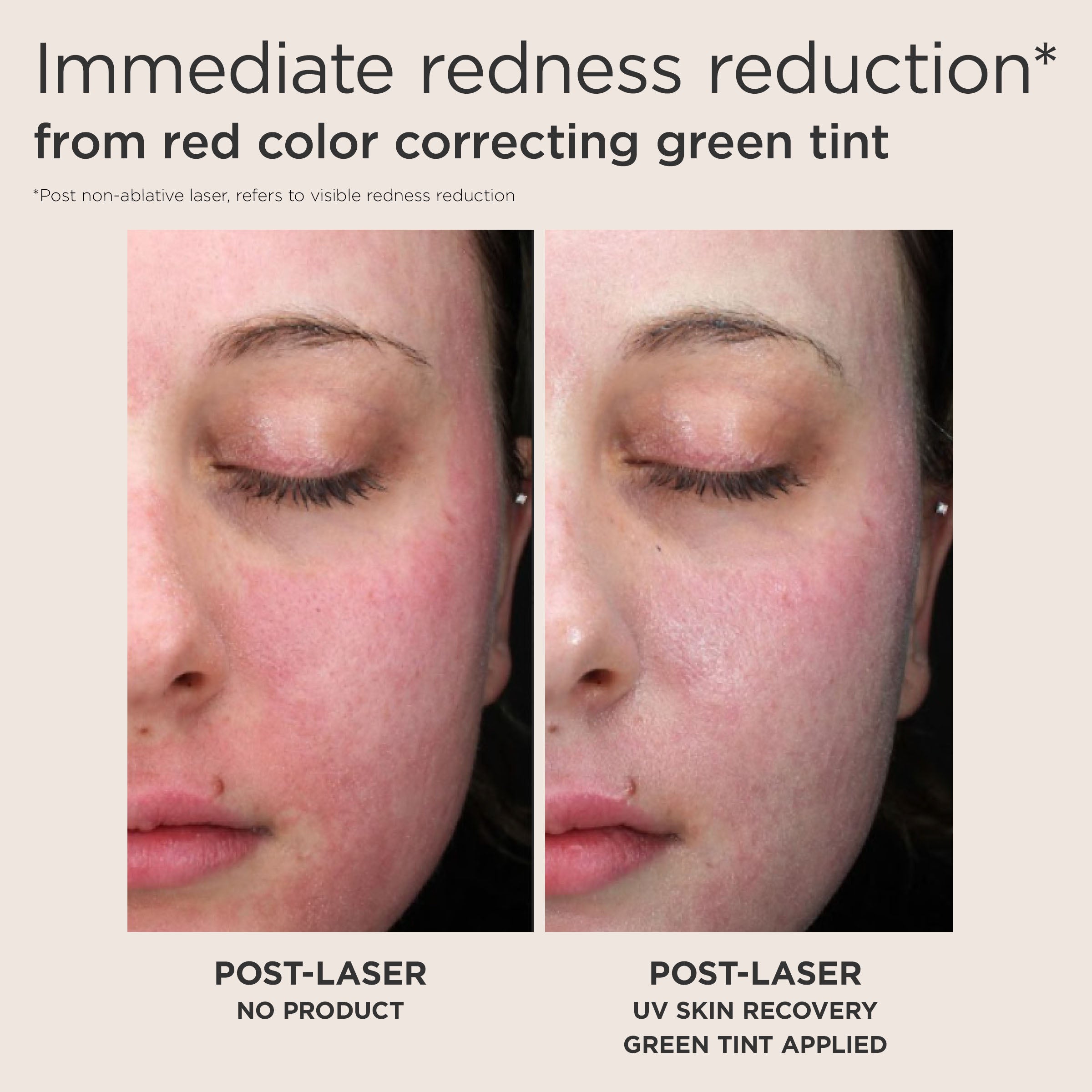 UV Skin Recovery Red Color Correcting SPF 50
