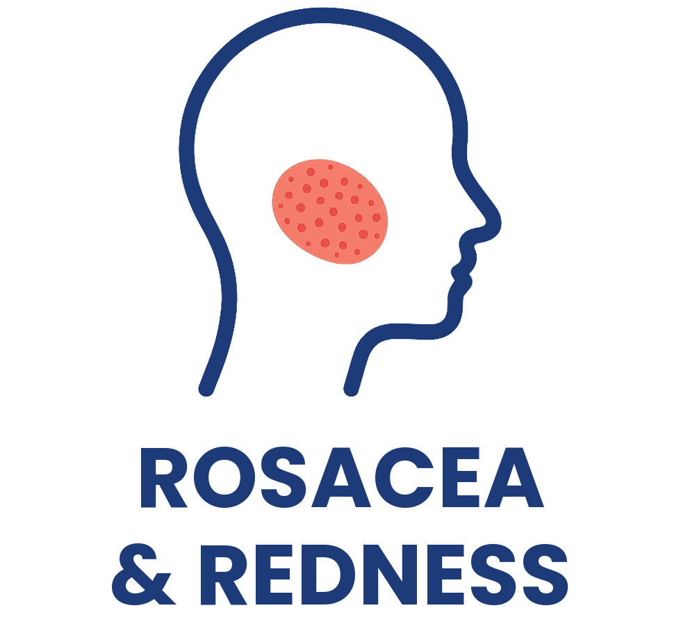 Rosacea and facial redness treatment