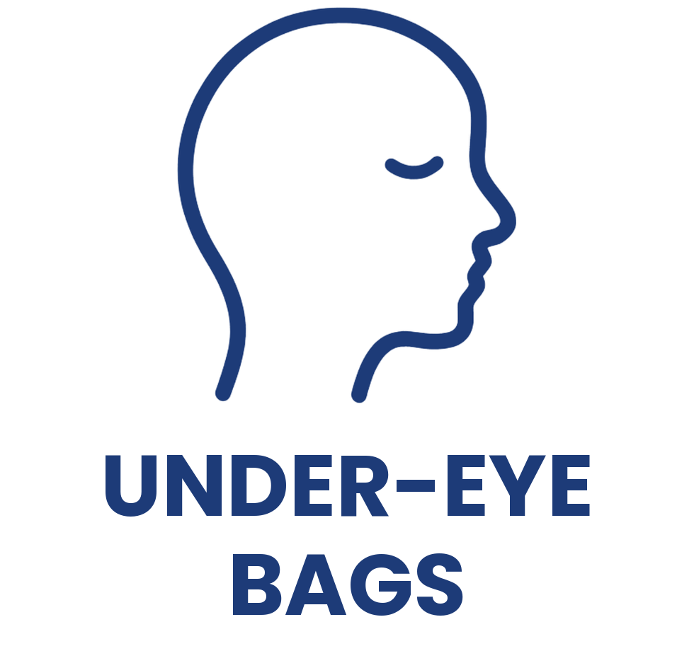 Under-eye bags treatment with OptiLift